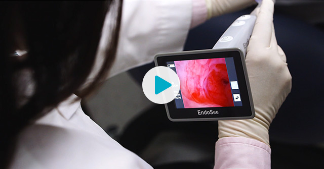 Watch Endosee in Action