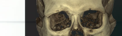 ProMax 3D Mid bg4