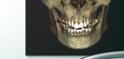 ProMax 3D Mid bg6
