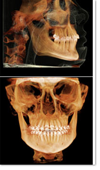 i-CAT Scans